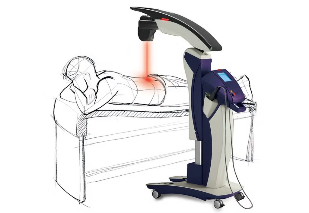 MLS Laser Therapy